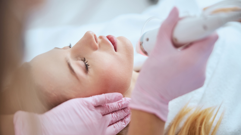 Microneedling