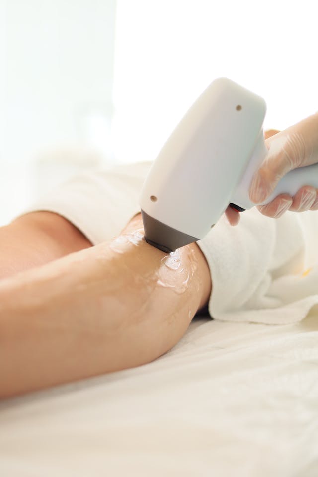 10 Things to Consider Before Laser Hair Removal in Toronto